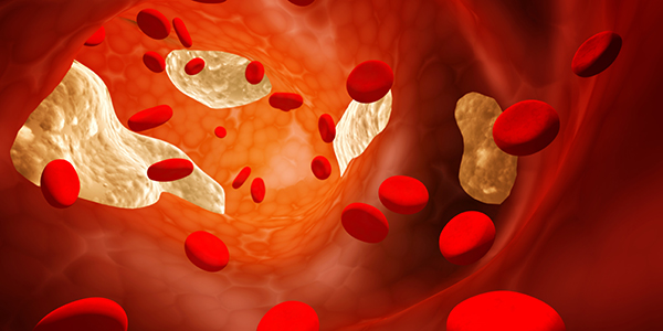 cholesterol social 12